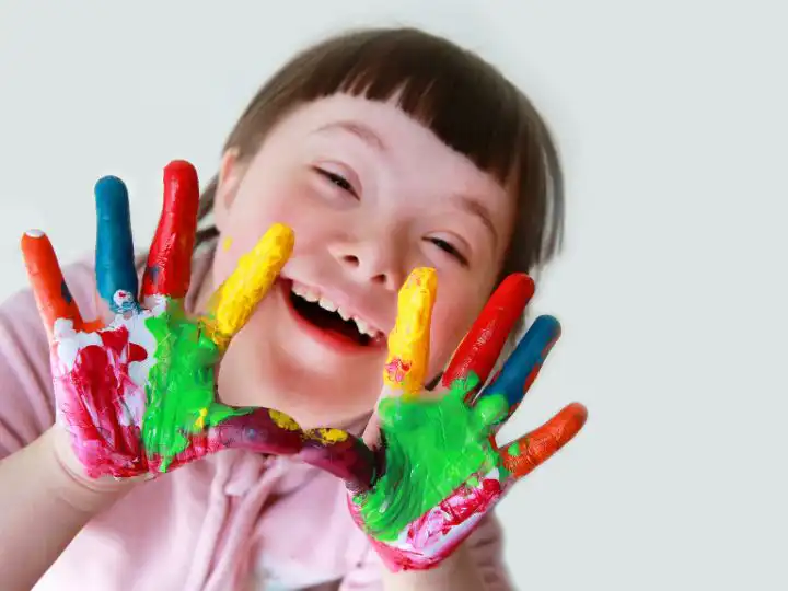 What is Rett Syndrome